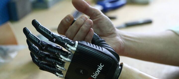 В НИУ ВШЭ создали нейросеть для управления протезом кисти руки